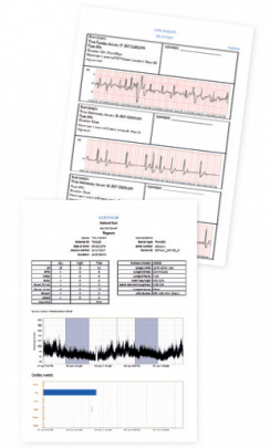 Bittium Cardiac Monitoring